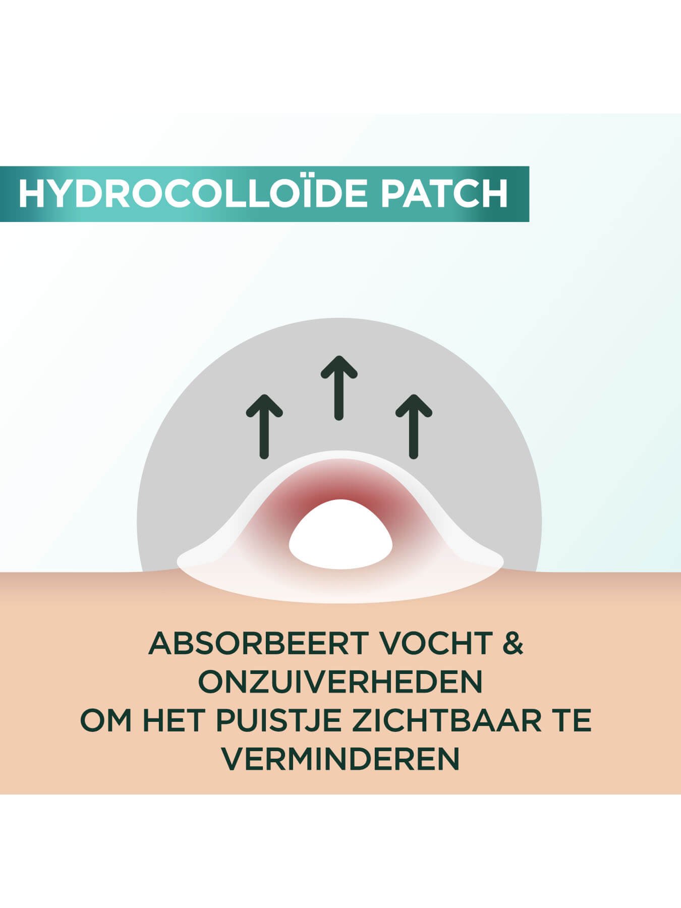 3600542573122 8 NL